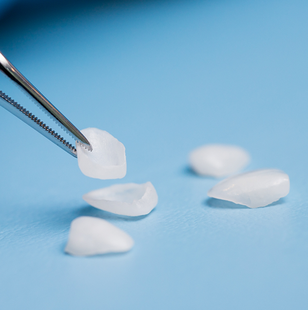 Tweezers holding a veneer