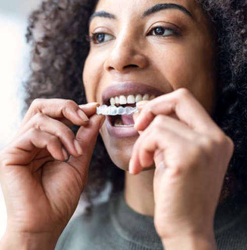 Woman inserting Invisalign over upper arch