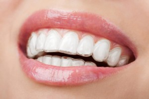 woman using invisalign virginia beach loves try it today