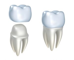 What are dental crowns, and how can they help make your teeth strong? Find out from your dentist in Virginia Beach, VA. 