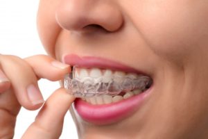 woman smiling inserting Invisalign aligner 