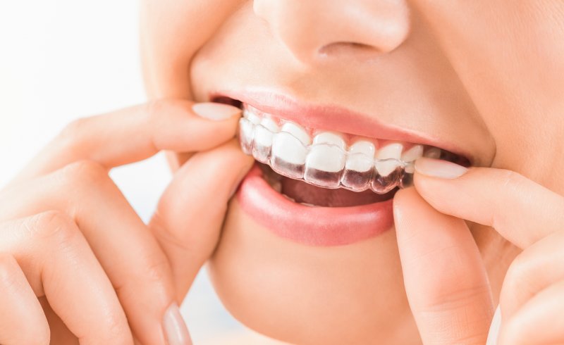 Woman wearing Invisalign retainer in Virginia Beach