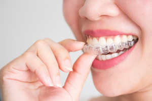 Close up of patient inserting an Invisalign aligner